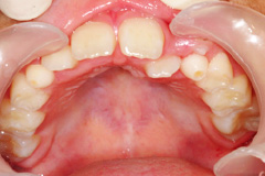 原宿こども歯科,矯正,北参道,千駄ヶ谷