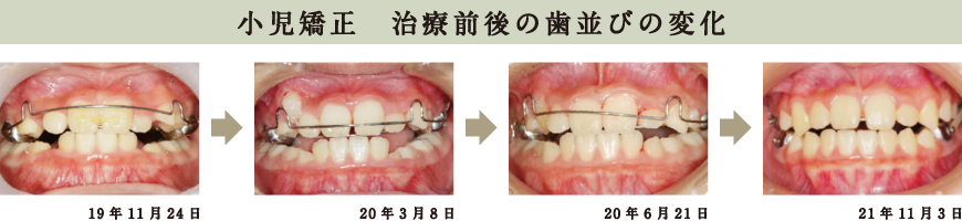 原宿こども歯科,矯正,北参道,千駄ヶ谷