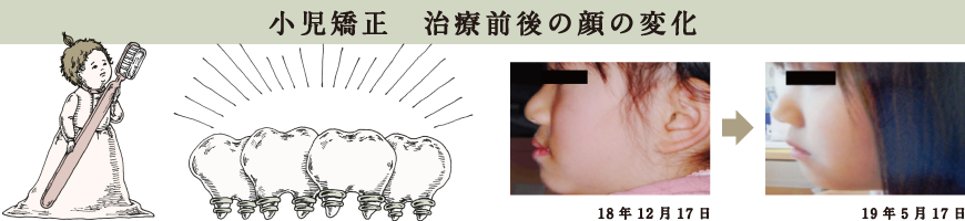 原宿こども歯科,矯正,北参道,千駄ヶ谷