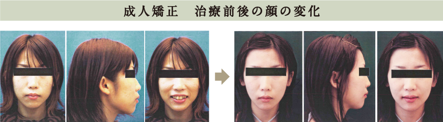 原宿こども歯科,矯正,北参道,千駄ヶ谷